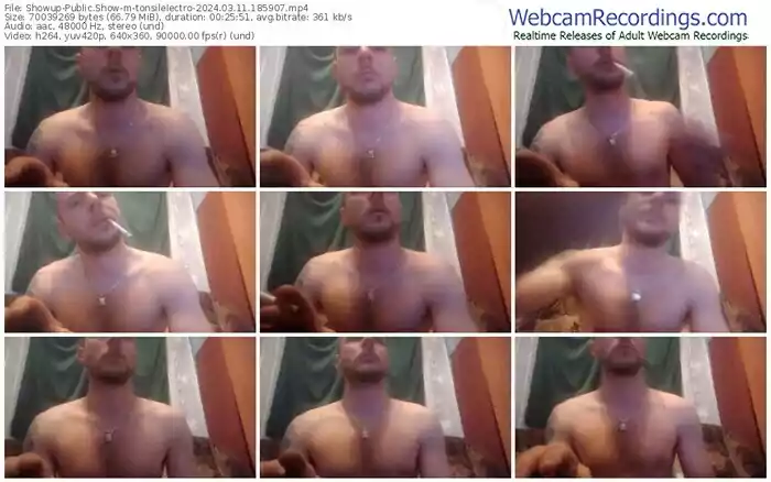 showup-tonsilelectro-03-11-2024-18-59-07