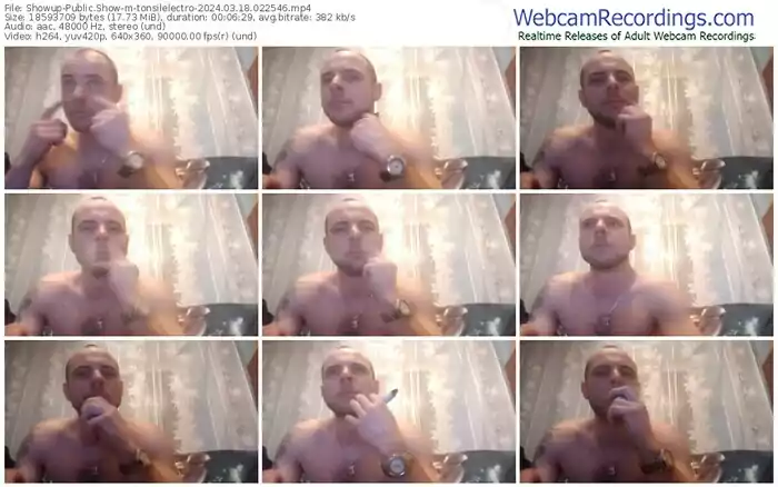 showup-tonsilelectro-03-18-2024-02-25-46