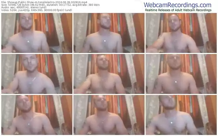 showup-tonsilelectro-08-28-2024-00-28-16